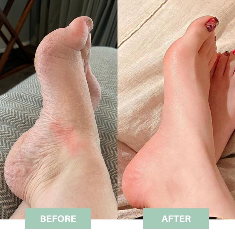 BlessFeet™ Mat EMS Inteligente para Pies | Alivio y Relajación | ¡Pídelo Hoy! ⚡🦶