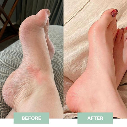 BlessFeet™ Mat EMS Inteligente para Pies | Alivio y Relajación | ¡Pídelo Hoy! ⚡🦶